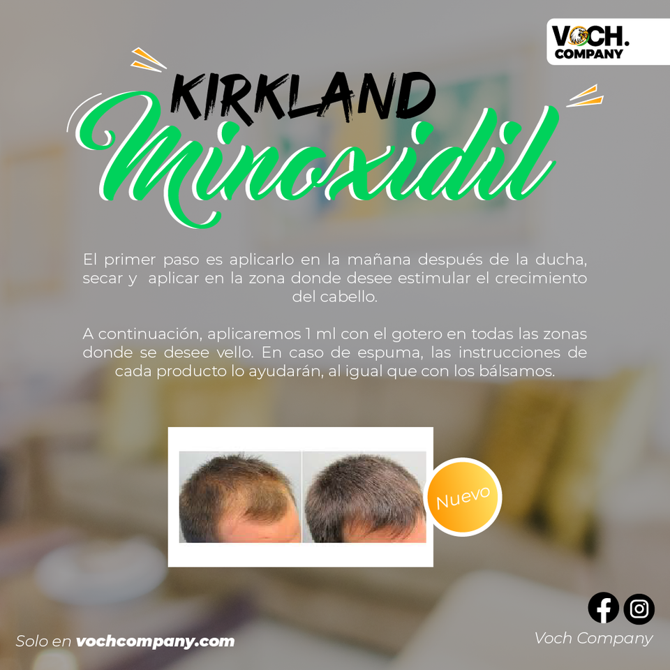 Barba abundante con Minoxidil Kirkland